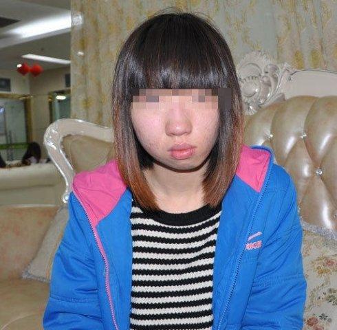 曹孟君救助揭阳歪脸女孩